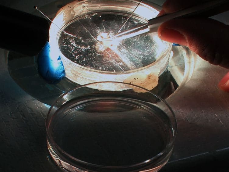 Recording Electrical Activity from Identified Neurons in the Intact Brain of Transgenic Fish