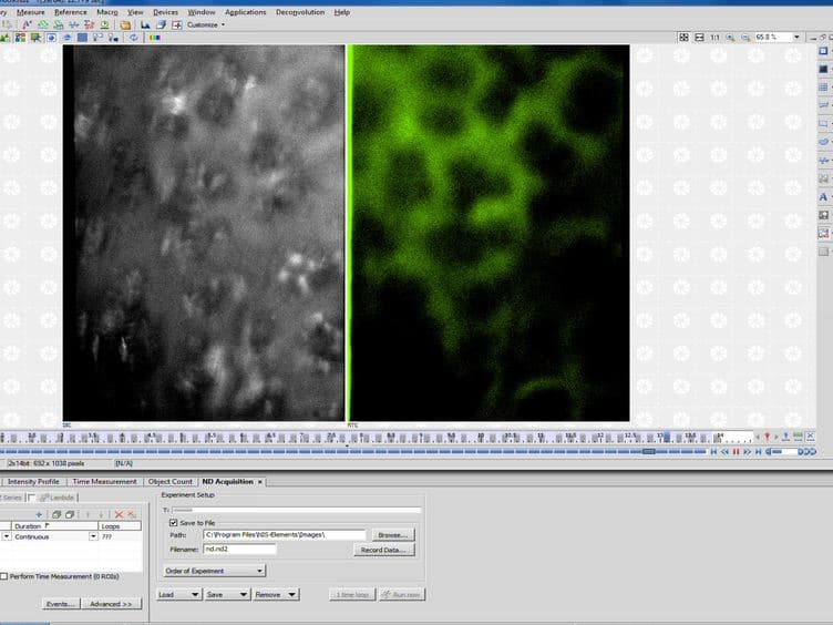 In vivo Measurement of the Mouse Pulmonary Endothelial Surface Layer