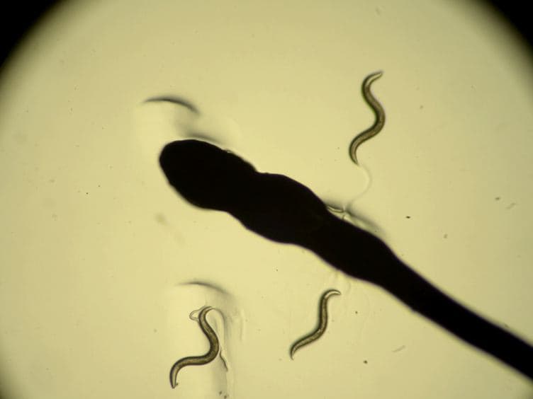 In vivo Neuronal Calcium Imaging in C. elegans