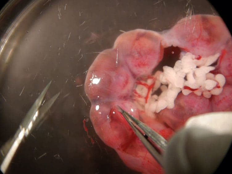 A Novel Ex vivo Culture Method for the Embryonic Mouse Heart