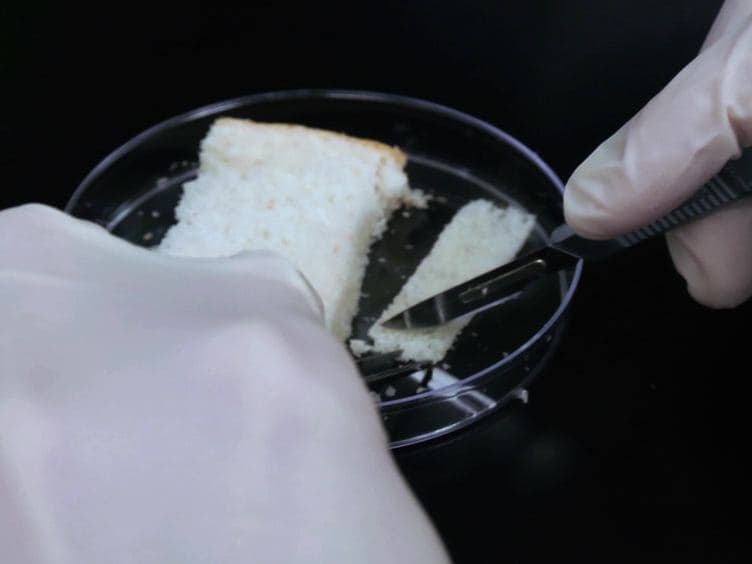 Oral Transmission of <em>Listeria monocytogenes</em> in Mice via Ingestion of Contaminated Food