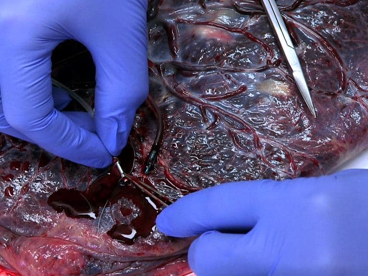 Determination of the Transport Rate of Xenobiotics and Nanomaterials Across the Placenta using the ex vivo Human Placental Perfusion Model