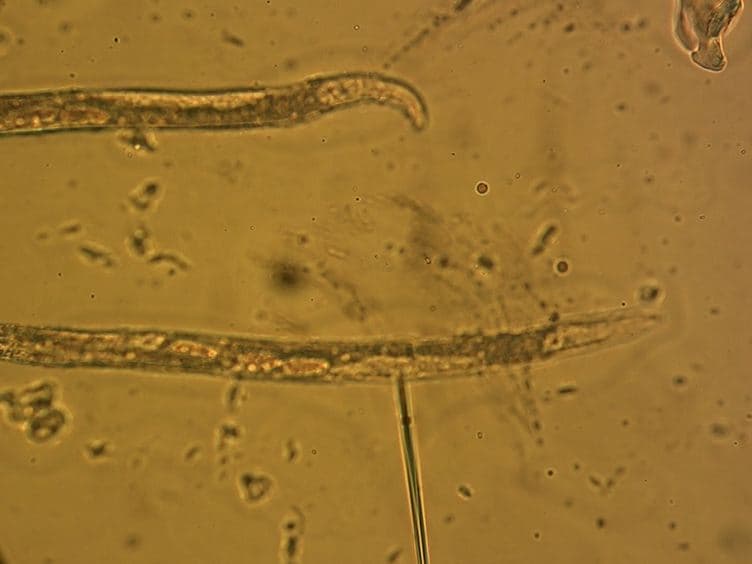 A <em>Caenorhabditis elegans</em> Model System for Amylopathy Study