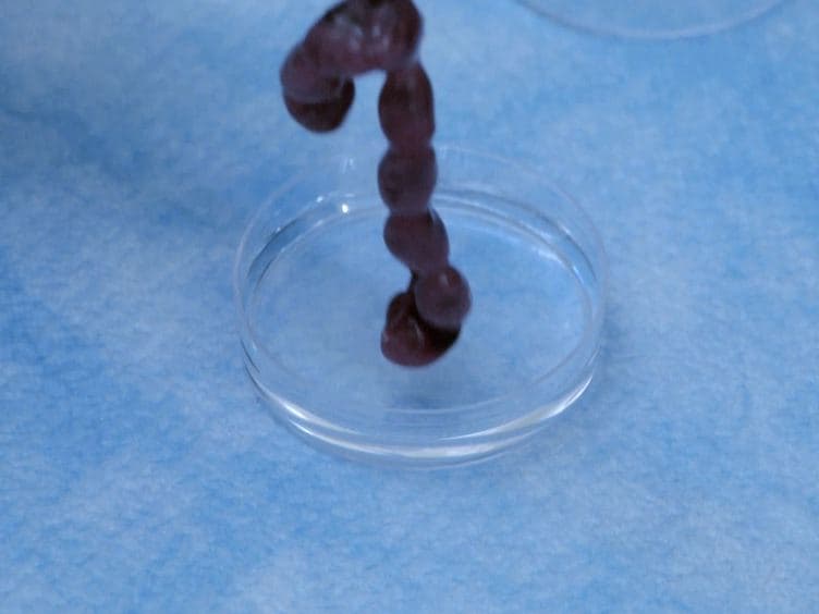 Isolation of Embryonic Ventricular Endothelial Cells