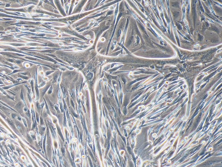 Transplantation of Induced Pluripotent Stem Cell-derived Mesoangioblast-like Myogenic Progenitors in Mouse Models of Muscle Regeneration