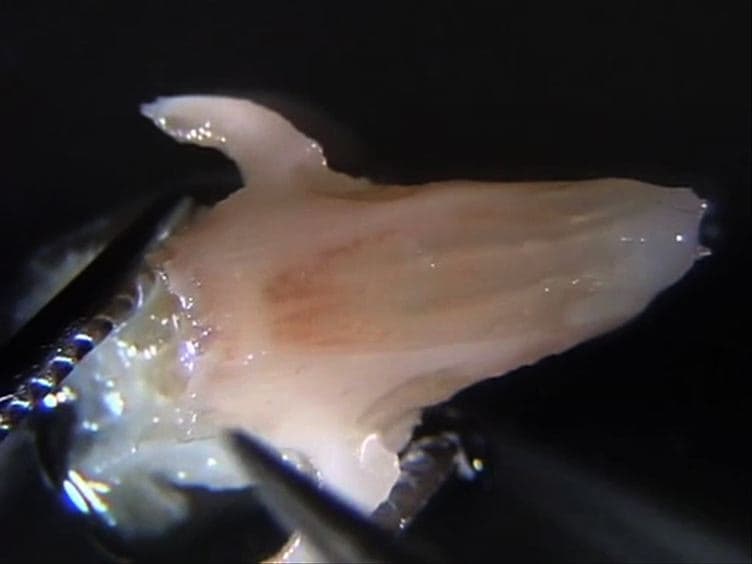 An Effective Manual Deboning Method To Prepare Intact Mouse Nasal Tissue With Preserved Anatomical Organization