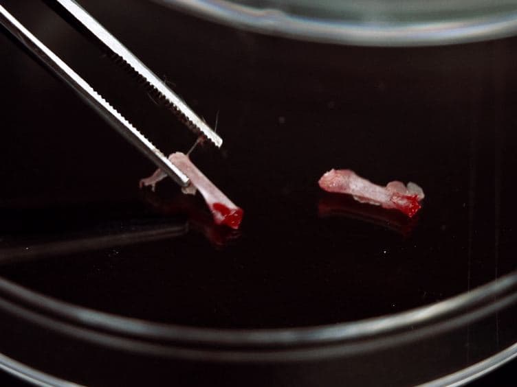 Pre-clinical Evaluation of Tyrosine Kinase Inhibitors for Treatment of Acute Leukemia