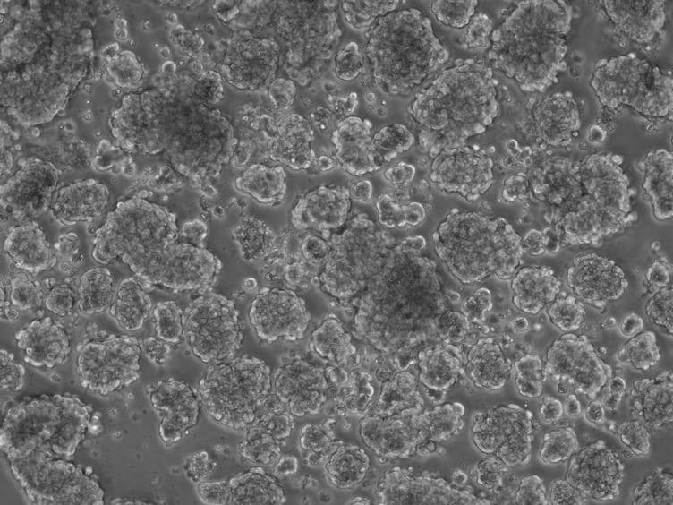 Isolation, Culture, and Imaging of Human Fetal Pancreatic Cell Clusters
