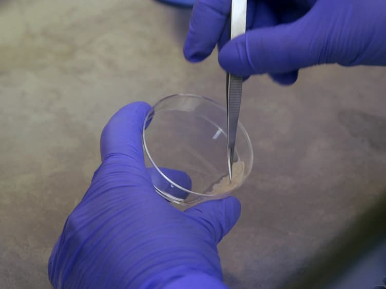 Calcium Phosphate Transfection of Primary Hippocampal Neurons