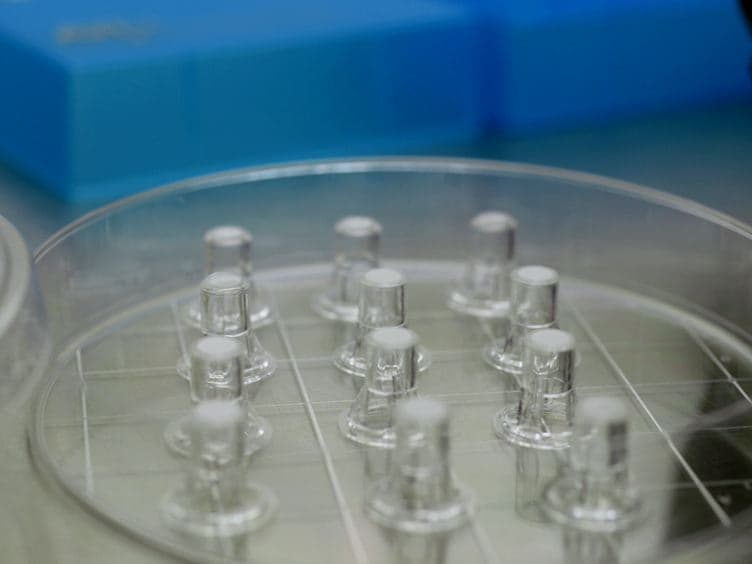 <em>In vitro</em> Coculture Assay to Assess Pathogen Induced Neutrophil Trans-epithelial Migration