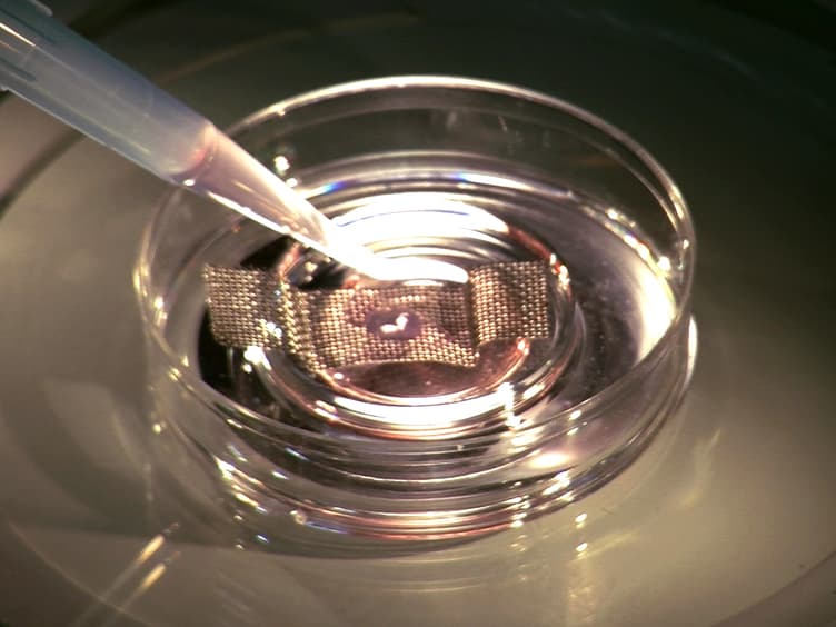 The Slice Culture Method for Following Development of Tooth Germs In Explant Culture