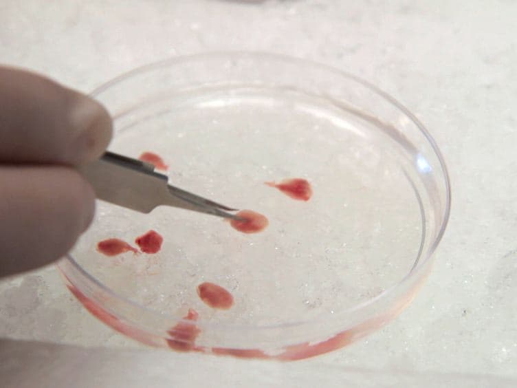 Isolation, Culture, and Transplantation of Muscle Satellite Cells