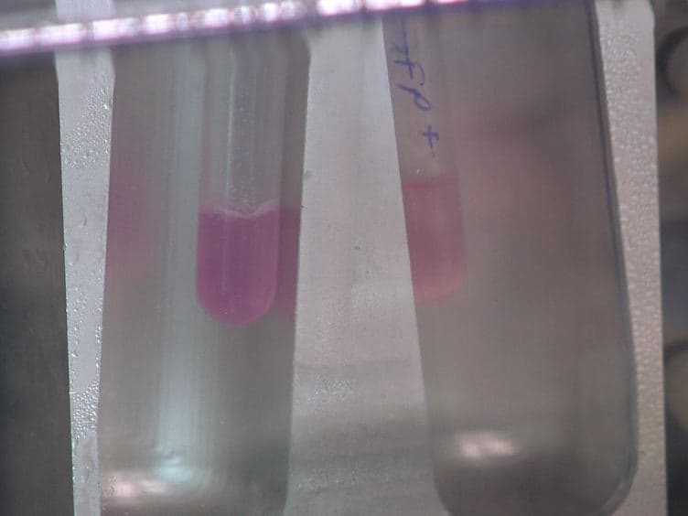 Enrichment and Purging of Human Embryonic Stem Cells by Detection of Cell Surface Antigens Using the Monoclonal Antibodies TG30 and GCTM-2