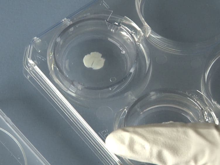 Coculture System with an Organotypic Brain Slice and 3D Spheroid of Carcinoma Cells