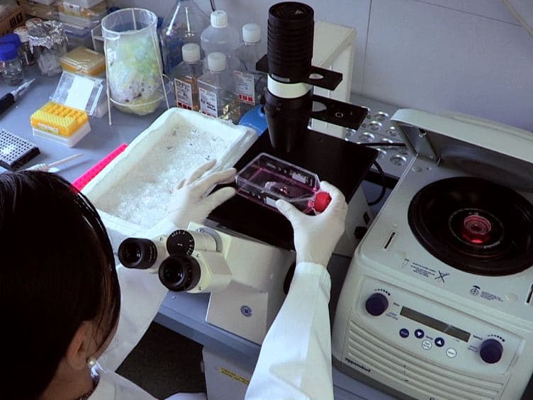 Stretch in Brain Microvascular Endothelial Cells (cEND) as an In Vitro Traumatic Brain Injury Model of the Blood Brain Barrier