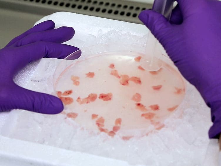 Isolation of Myeloid Dendritic Cells and Epithelial Cells from Human Thymus