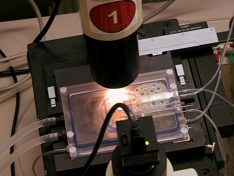 Videomorphometric Analysis of Hypoxic Pulmonary Vasoconstriction of Intra-pulmonary Arteries Using Murine Precision Cut Lung Slices