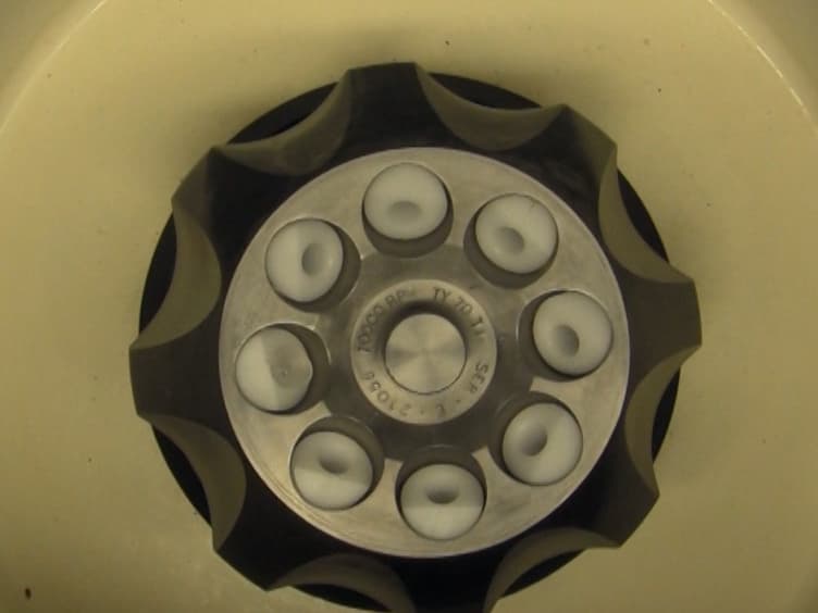 An Innovative Method for Exosome Quantification and Size Measurement