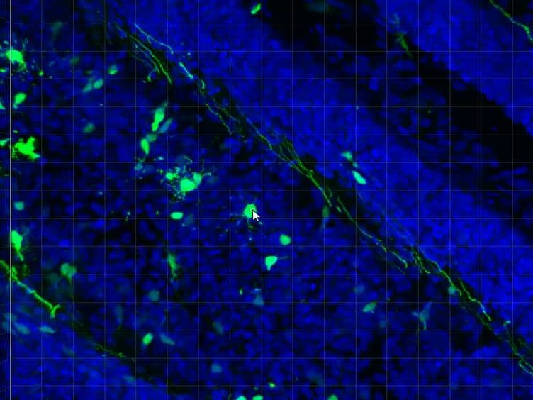 Genetic Manipulation of Cerebellar Granule Neurons <em>In Vitro</em> and <em>In Vivo</em> to Study Neuronal Morphology and Migration