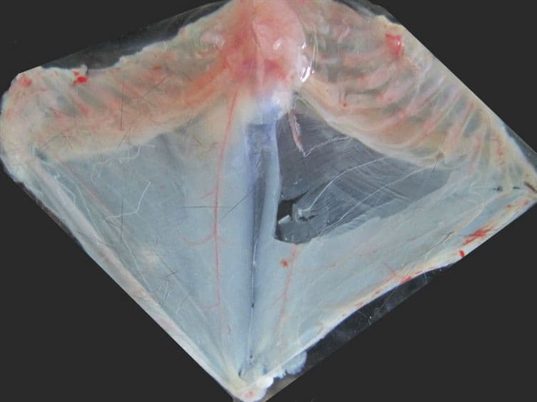 Dissection of the Transversus Abdominis Muscle for Whole-mount Neuromuscular Junction Analysis