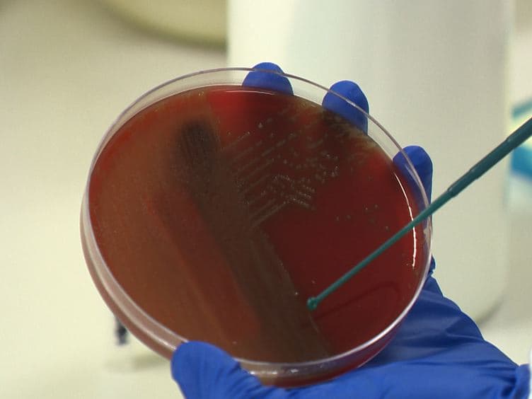 Capsular Serotyping of <em>Streptococcus pneumoniae</em> Using the Quellung Reaction