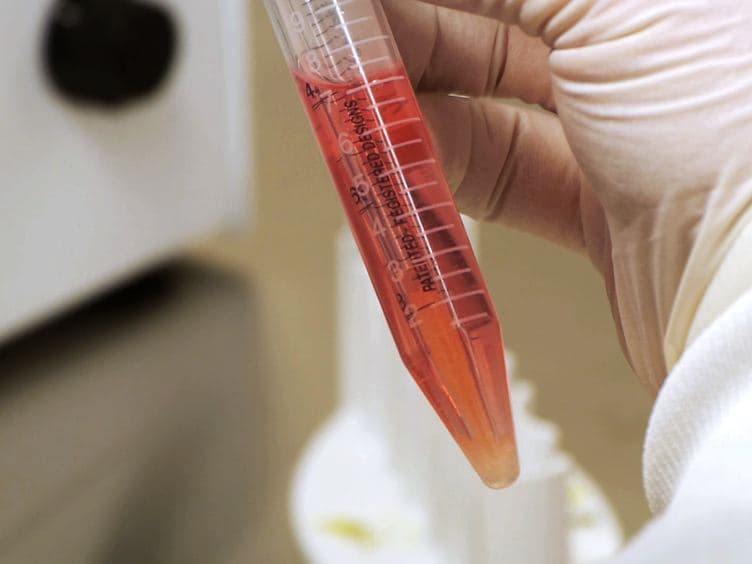 A cGMP-applicable Expansion Method for Aggregates of Human Neural Stem and Progenitor Cells Derived From Pluripotent Stem Cells or Fetal Brain Tissue