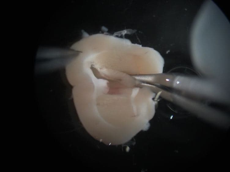 One Mouse, Two Cultures: Isolation and Culture of Adult Neural Stem Cells from the Two Neurogenic Zones of Individual Mice