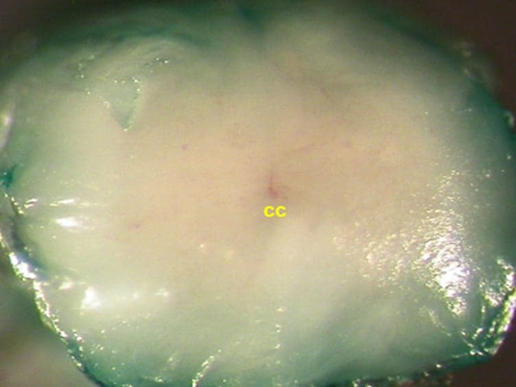 In Vivo SiRNA Transfection and Gene Knockdown in Spinal Cord via Rapid Noninvasive Lumbar Intrathecal Injections in Mice