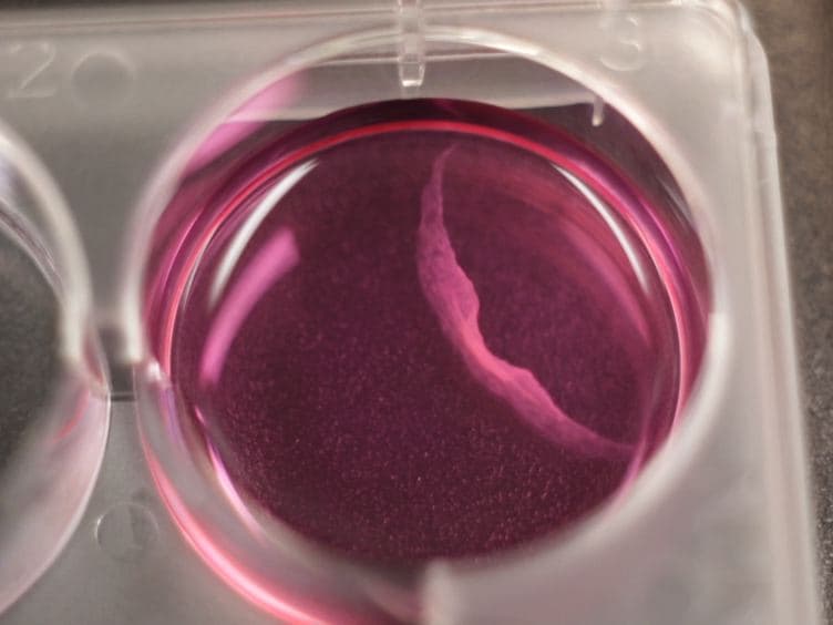 Tissue Engineering of Tumor Stromal Microenvironment with Application to Cancer Cell Invasion