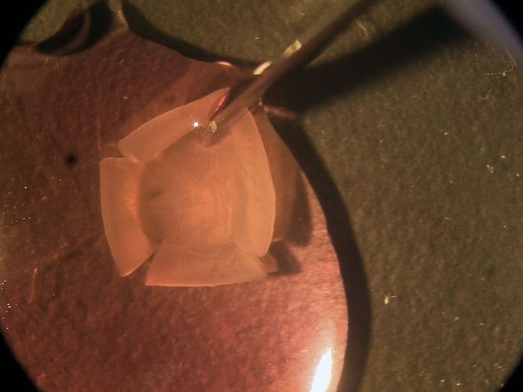 Immunohistochemical and Calcium Imaging Methods in Wholemount Rat Retina