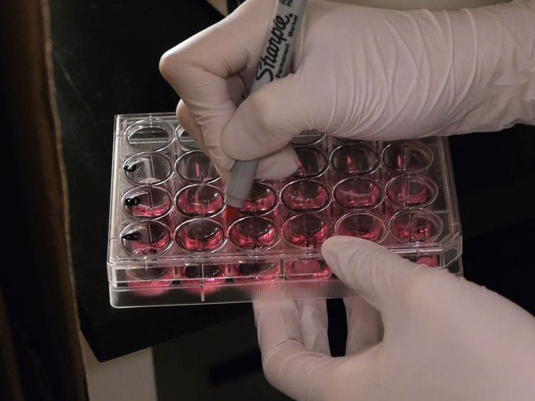 Efficient Generation Human Induced Pluripotent Stem Cells from Human Somatic Cells with Sendai-virus