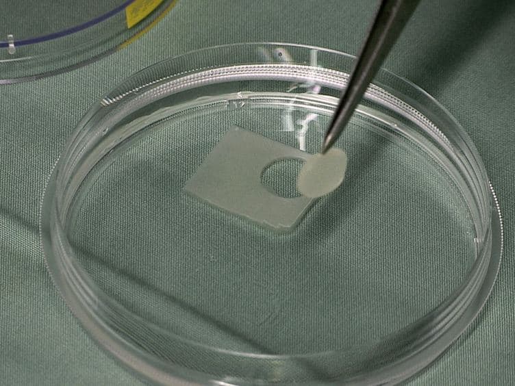 A Full Skin Defect Model to Evaluate Vascularization of Biomaterials <em>In Vivo</em>