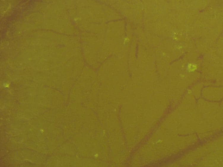 Two-Photon in vivo Imaging of Dendritic Spines in the Mouse Cortex Using a Thinned-skull Preparation
