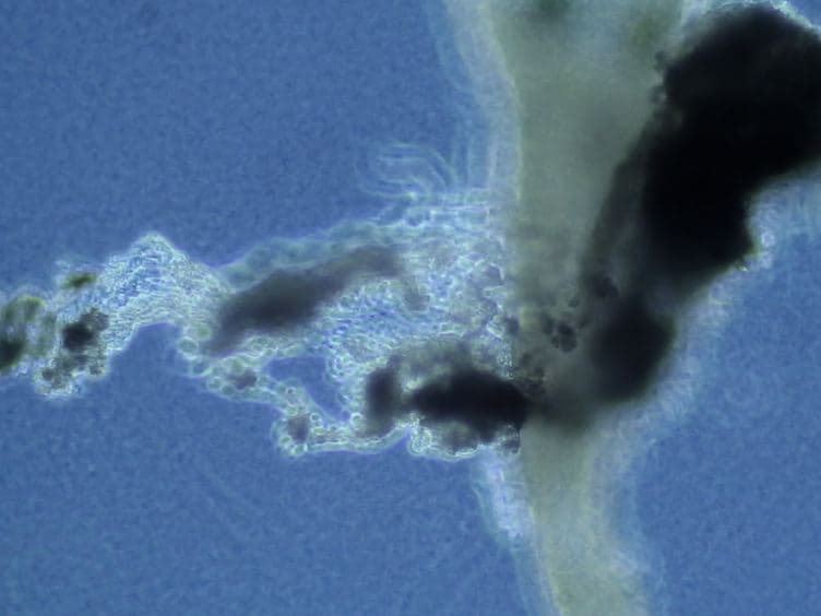 Isolation of Neonatal Extrahepatic Cholangiocytes