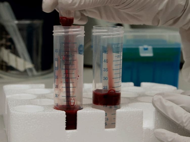 Static Adhesion Assay for the Study of Integrin Activation in T Lymphocytes