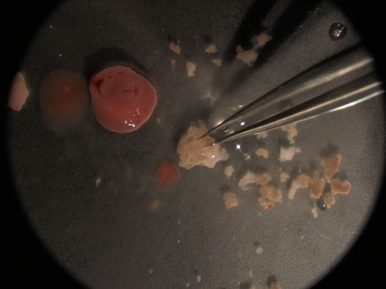 Isolation of Murine Valve Endothelial Cells