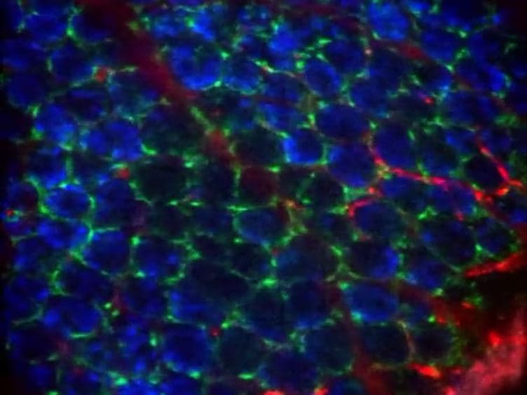Real-time Imaging of Myeloid Cells Dynamics in <em>Apc<sup>Min/+</sup></em> Intestinal Tumors by Spinning Disk Confocal Microscopy