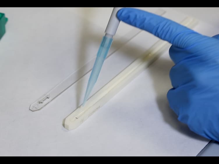 From a 2DE-Gel Spot to Protein Function: Lesson Learned From HS1 in Chronic Lymphocytic Leukemia