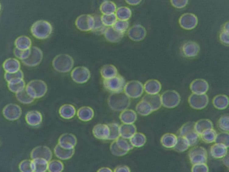 Highly Efficient Transfection of Human THP-1 Macrophages by Nucleofection