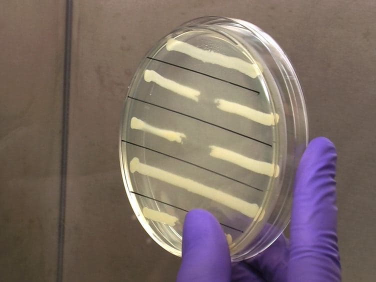 Non-Invasive Model of Neuropathogenic <em>Escherichia coli</em> Infection in the Neonatal Rat