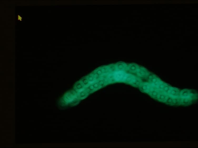 Methods to Assess Subcellular Compartments of Muscle in <em>C. elegans</em>