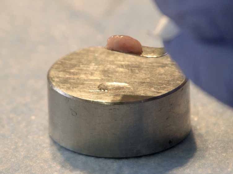 Slice It Hot: Acute Adult Brain Slicing in Physiological Temperature