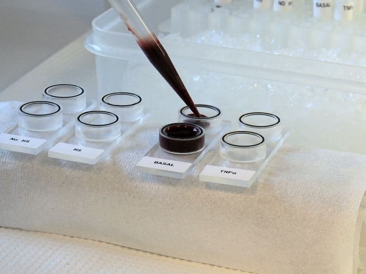 A Novel In vitro Model for Studying the Interactions Between Human Whole Blood and Endothelium