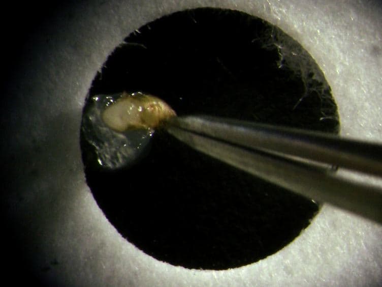 Live-imaging of the <em>Drosophila</em> Pupal Eye