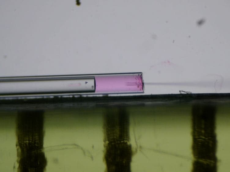 A Possible Zebrafish Model of Polycystic Kidney Disease: Knockdown of <em>wnt5a</em> Causes Cysts in Zebrafish Kidneys