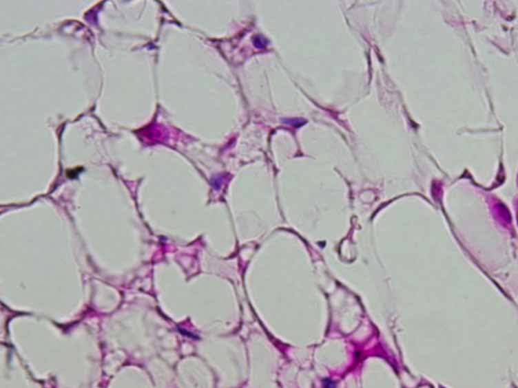 Localization, Identification, and Excision of Murine Adipose Depots