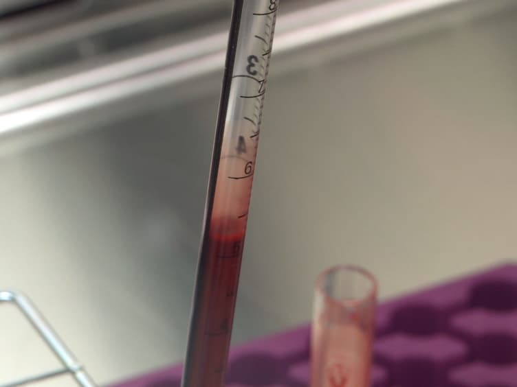 Detecting Glycogen in Peripheral Blood Mononuclear Cells with Periodic Acid Schiff Staining