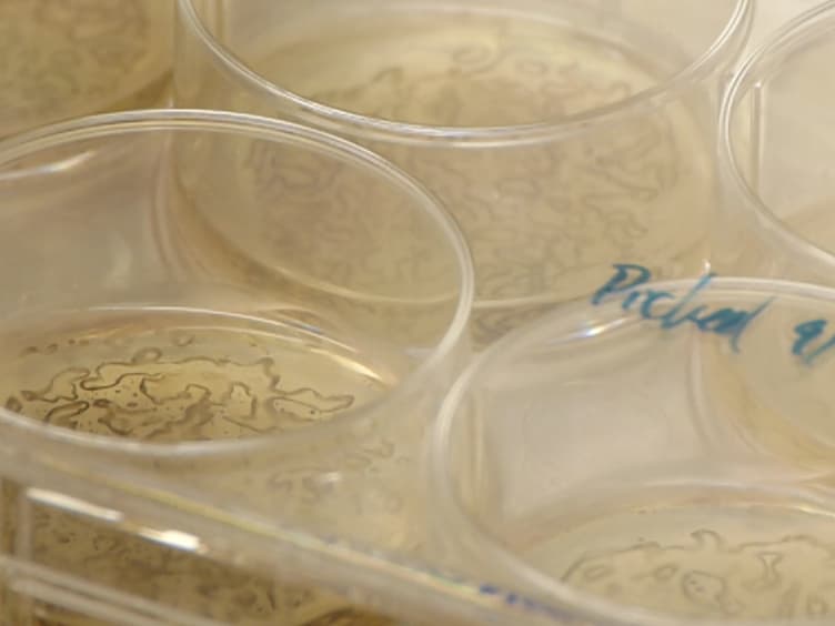 Efficient Derivation of Retinal Pigment Epithelium Cells from Stem Cells