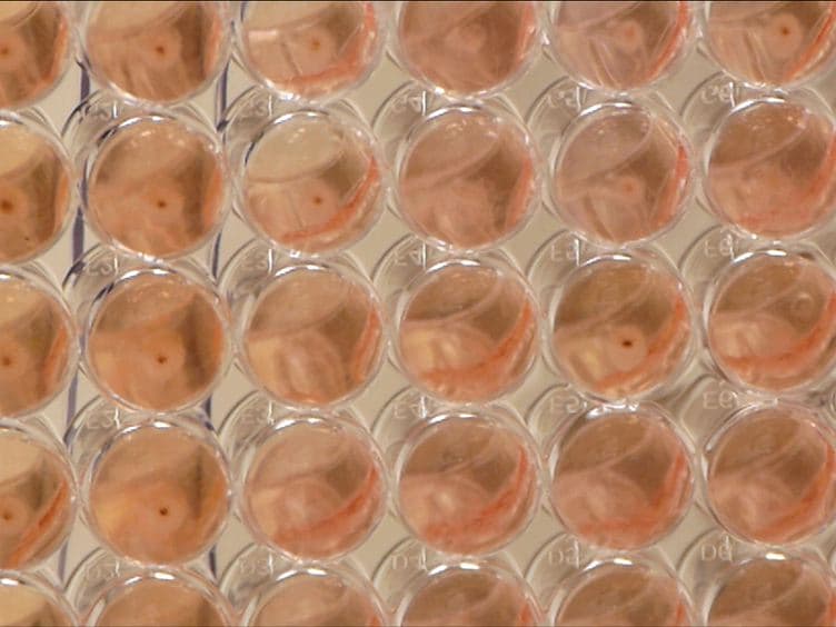 Generation of Human Alloantigen-specific T Cells from Peripheral Blood