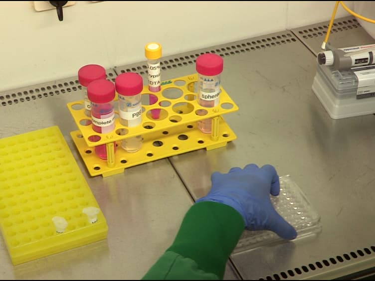Evaluation of Stem Cell Properties in Human Ovarian Carcinoma Cells Using Multi and Single Cell-based Spheres Assays